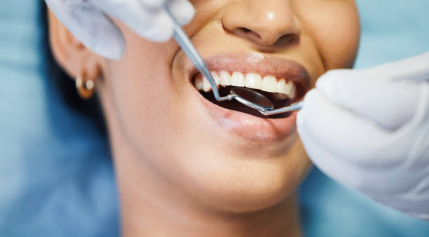 Best Emergency Denture Repair in Collinsville, MS